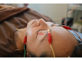 いろはり/施術風景8