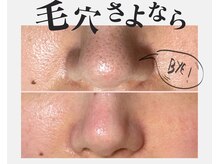 アンドビー(&B)の雰囲気（黒ずみ、産毛を根本除去！毛穴ケア&EMS&幹細胞の極上ケア！）