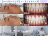 【ハーブピーリング×ホワイトニング】ホットペッパー限定31,400円→20,000円