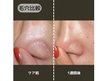 サロンドール(Salon doll)の雰囲気（毛穴レス小顔リフトなど色々なお悩みに対応◎【心斎橋エステ】）
