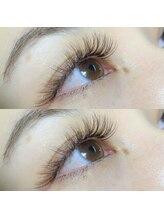 ブロッサ(Blossa)/バインドロック120束