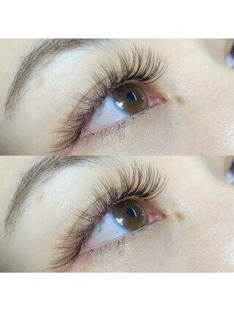 ブロッサ(Blossa)/バインドロック120束