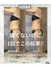 エネイブル(ENable)/