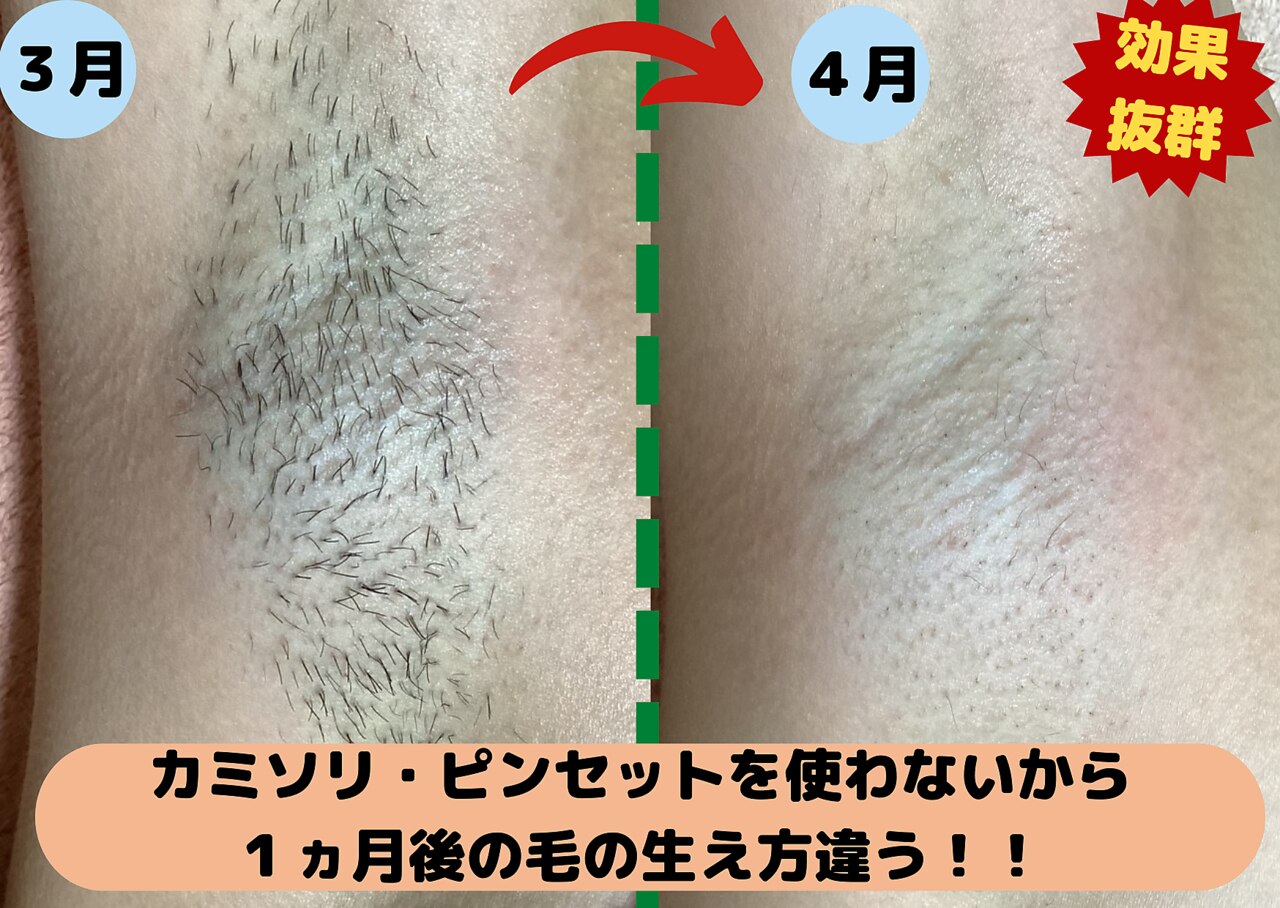 ディスイズミー シュガーリング(This is me Sugaring)｜ホットペッパー
