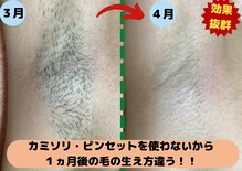 ディスイズミー シュガーリング(This is me Sugaring)
