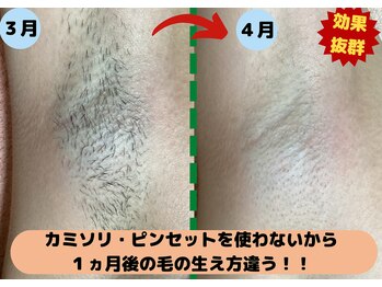 ディスイズミー シュガーリング(This is me Sugaring)