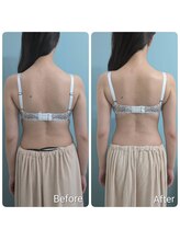 美人バスト 柏店/【バストアップ・育乳】背中美人