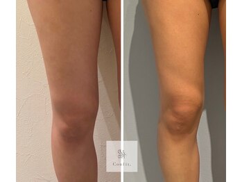 ソナ 大和西大寺院(SONA)/