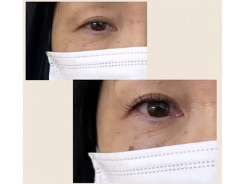 ラグジュアリーアイズ(Luxury eyes)/お目元タルミ改善