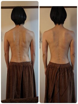 エル(eL)/お背中美人☆