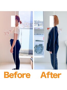 整体院ひなた 都城院/産後の腰痛改善