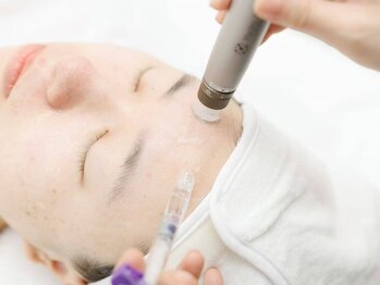 ユミサロン(U Mi Salon)の写真/《話題の水光肌ピーリングで赤ちゃんのような透明肌へ》今までの肌よりワントーンUPして憧れの素肌美人に！