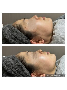 サイ(Sai)/毛穴特化高濃度ビタミン生パック