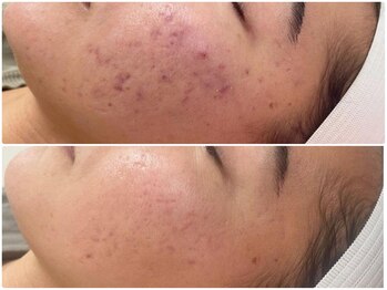 エミマス ボーテ(Emimas Beaute’)/悩みを繰り返さない肌作り