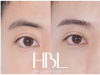 リンネ(Rinne)/【HBL】before/after