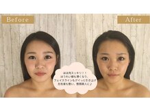 グレースフィオーレ 吉祥寺店(gracefiore)/ビフォーアフター