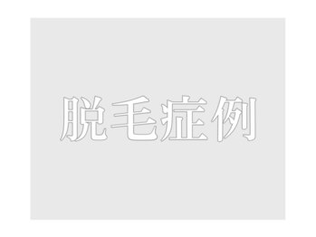 メラヴィー 上社店(meravi)/施術症例↓