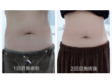 ルアナ(Luana)/痩身ならLuanaにお任せ♪