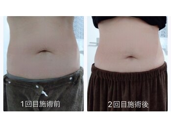 ルアナ(Luana)/痩身ならLuanaにお任せ♪