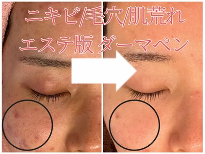 サロンド ララ(Salon de lala)の写真