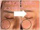 サロンド ララ(Salon de lala)の写真