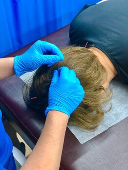 ライジング鍼灸接骨院/育毛促進