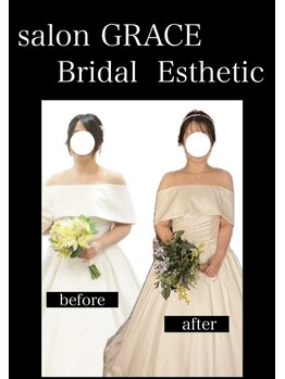 サロン グレイス(salon GRACE)/
