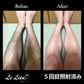 ルリアン(Le Lien)