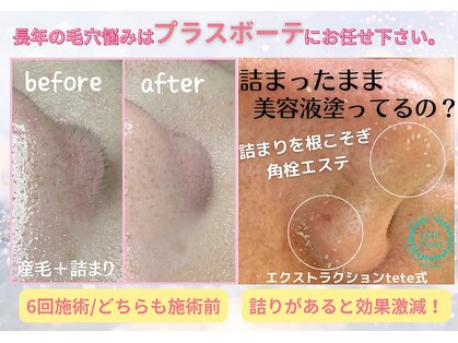 プラスボーテ 北参道(plus beaute)の写真