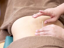 あうる鍼灸接骨院 整体院/【鍼灸】肩こり/腰痛/疲労/歪み