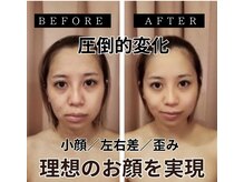 わたしの 大阪枚方本店の雰囲気(劇的変化★小顔コルギでお顔+上半身のお悩みを徹底アプローチ!)