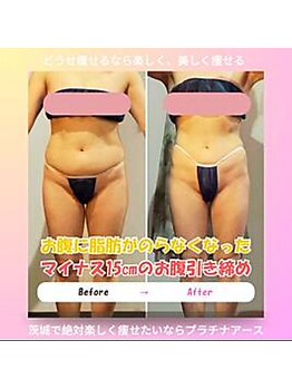 プラチナアース つくば店(Platinum earth)/見た目年齢マイナス10歳へ