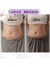 グランディールアン(GRANDIR UN)/スッキリ