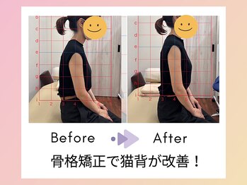 鈴木接骨院 泉区将監院/骨格矯正について