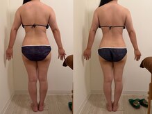 アル 本町店(allu)/背中が変わる｜3ヶ月