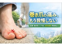 巻き爪じゅん 千葉駅前店/根本改善するために大切なこと