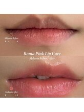 韓国肌管理yeoun【ヨウン】ROMAPINK/黒ずみ/毛穴/プラピール/ララピール福岡天神/ローマピンク福岡/メラニンケア