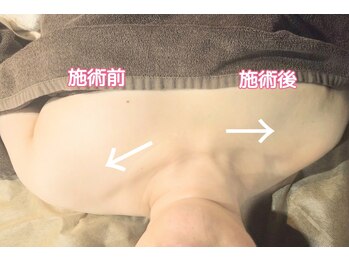 和顔愛語の写真/肩首こり頭痛からの解放は気分もスッキリ！長年何をやってもダメだった‥和顔愛語もケア受けてみてください