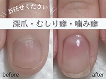 アメジスト(Amethyst)