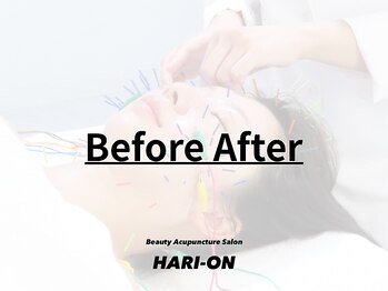 ハリオン 中目黒(HARI-ON)/Before After