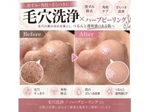 シーズ(C'ies)の雰囲気（毛穴洗浄で黒ずみ・角栓・ざらつきケア◎つるんと美肌）