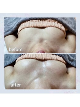 セレーネ(Selene)/お客様before.after