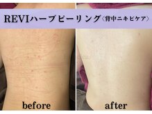 エステレア(Esthelea)の雰囲気（ブライダル前に大人気！お顔とセットクーポンもご用意あります★）