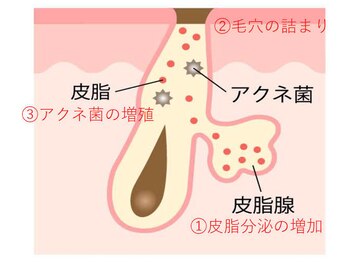 ザ エステティック福岡/表面のケアからでなく原因から