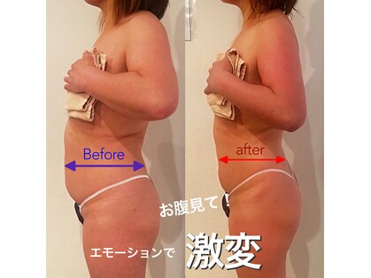 エモーション(E Motion)の写真
