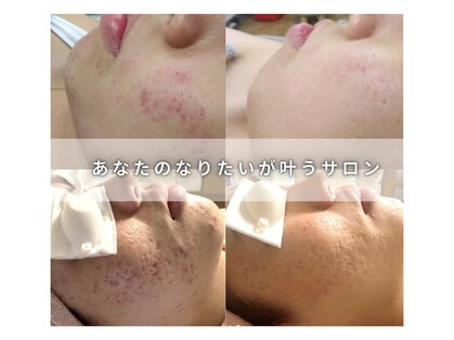キザシ(kizashi)の写真
