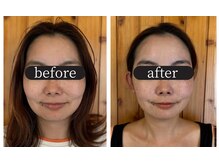 りせる整体院(Recell)の雰囲気(小顔矯正+美顔リンパマッサージで理想の小顔に/たるみ/エラ張り)