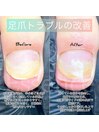 足爪トラブルもご相談ください。