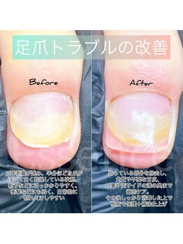 エッセンス (Essence)/足爪トラブルもご相談ください。