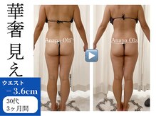 アナパ・オラ/オトナ女子の華奢見え痩身